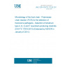 UNE CEN ISO/TS 17919:2013 Microbiology of the food chain - Polymerase chain reaction (PCR) for the detection of food-borne pathogens - Detection of botulinum type A, B, E and F neurotoxin-producing clostridia (ISO/TS 17919:2013) (Endorsed by AENOR in January of 2014.)